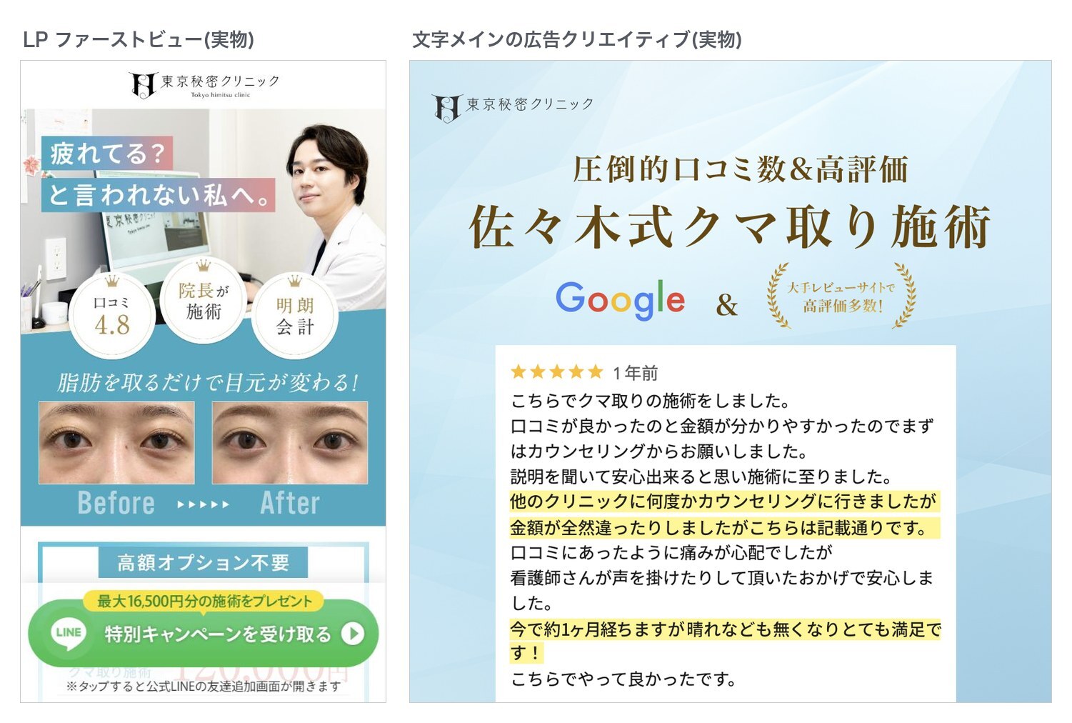 実物のLPファーストビュー(疲れてる？と言われない私へ。口コミ4.8・院長が施術・明朗会計のバッジ付き)と、口コミレビューを全文掲載した文字メインの広告クリエイティブ